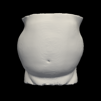 Abdominal surface mesh sample 1