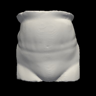 Abdominal surface mesh sample 4
