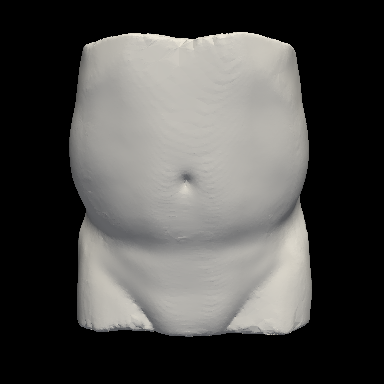 Abdominal surface mesh sample 2